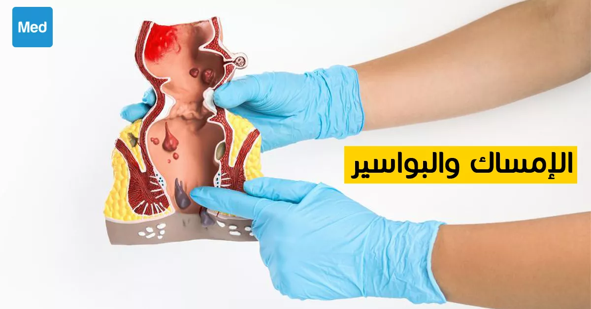 الإمساك والبواسير